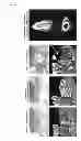 Fig. 09 - Method For Restoring Alveolar Bone Via Transplant of a Regenerated Tooth Unit