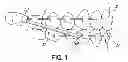 Fig. 02 - ORTHODONTIC DEVICE AND METHOD FOR TREATING MALOCCLUSIONS
