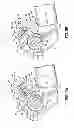 Fig. 06 - ORTHODONTIC DEVICE AND METHOD FOR TREATING MALOCCLUSIONS