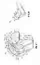 Fig. 08 - ORTHODONTIC DEVICE AND METHOD FOR TREATING MALOCCLUSIONS