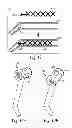 Fig. 06 - Device for dispensing material