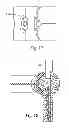 Fig. 09 - Device for dispensing material