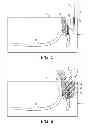 Fig. 06 - Denture and method and apparatus of making same
