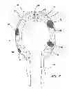 Fig. 07 - Simulated tissue structure for surgical training