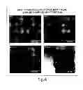 Fig. 16 - METHODS FOR THE DETECTION OF JC POLYOMA VIRUS