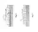Fig. 03 - Method of forming an integrated circuit