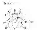 Fig. 02 - Static Electric Toy