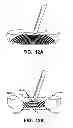 Fig. 09 - Putter heads and putters including polymeric material as part of the ball striking face