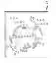 Fig. 13 - METHODS FOR THE ANALYSIS OF BREAST CANCER DISORDERS