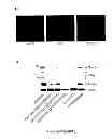 Fig. 07 - METHODS OF INHIBITING TUMOR CELL AGGRESSIVENESS USING THE MICROENVIRONMENT OF HUMAN EMBRYONIC STEM CELLS