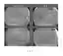 Fig. 06 - Methods and compositions for controlling vascularization in ophthalmological and dermatological diseases
