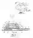 Fig. 02 - Implantable injection port