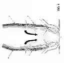 Fig. 02 - Method and apparatus for endoscopically treating rectal prolapse