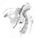 Fig. 08 - Method and apparatus for endoscopically treating rectal prolapse