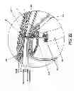 Fig. 22 - Method and apparatus for endoscopically treating rectal prolapse
