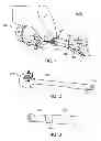 Fig. 02 - Jawed trocar assembly