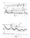 Fig. 02 - SYSTEM AND METHOD FOR DETECTING SYMPTOMS OF HYPOGLYCEMIA