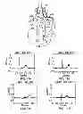 Fig. 06 - System and method for wireless generation of standard ECG leads and an ECG sensing unit therefor