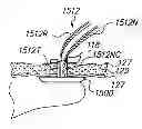Fig. 01 - Port System and Methods