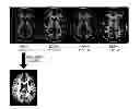 Fig. 01 - Atlas-based analysis for image-based anatomic and functional data of organism
