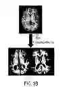 Fig. 07 - Atlas-based analysis for image-based anatomic and functional data of organism