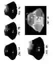 Fig. 08 - Method and apparatus for photomagnetic imaging