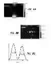Fig. 09 - Method and apparatus for photomagnetic imaging