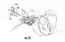 Fig. 28 - MRI-guided medical interventional systems and methods