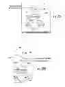 Fig. 32 - MRI-guided medical interventional systems and methods
