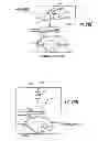 Fig. 33 - MRI-guided medical interventional systems and methods