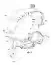 Fig. 52 - MRI-guided medical interventional systems and methods