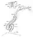 Fig. 01 - Minimally invasive lung volume reduction devices, methods, and systems