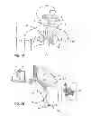 Fig. 02 - Minimally invasive lung volume reduction devices, methods, and systems