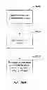 Fig. 33 - Minimally invasive lung volume reduction devices, methods, and systems