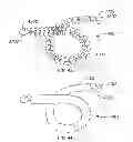 Fig. 35 - Minimally invasive lung volume reduction devices, methods, and systems