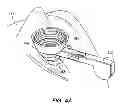 Fig. 07 - PATIENT INTERFACE FOR OPHTHALMOLOGIC DIAGNOSTIC AND INTERVENTIONAL PROCEDURES