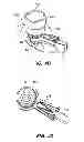 Fig. 09 - PATIENT INTERFACE FOR OPHTHALMOLOGIC DIAGNOSTIC AND INTERVENTIONAL PROCEDURES