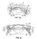 Fig. 22 - PATIENT INTERFACE FOR OPHTHALMOLOGIC DIAGNOSTIC AND INTERVENTIONAL PROCEDURES