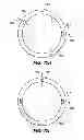 Fig. 35 - PATIENT INTERFACE FOR OPHTHALMOLOGIC DIAGNOSTIC AND INTERVENTIONAL PROCEDURES