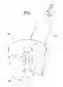 Fig. 02 - Ultrasound Guided Probe Device and Methods of Using Same