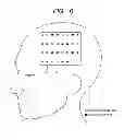 Fig. 07 - Biological photometric device and biological photometry method using same