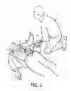 Fig. 02 - Pediatric patient-safe CPR device