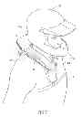 Fig. 08 - Neck collar