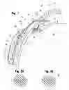 Fig. 02 - Glaucoma drainage shunts and methods of use