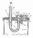 Fig. 01 - Wound drainage control apparatus