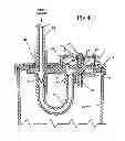 Fig. 04 - Wound drainage control apparatus