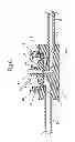 Fig. 06 - Wound drainage control apparatus