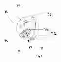 Fig. 07 - Wound drainage control apparatus