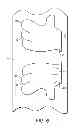 Fig. 07 - Absorbent Article Having A Discrete Portion