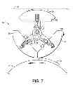 Fig. 08 - Absorbent Article Having A Discrete Portion
